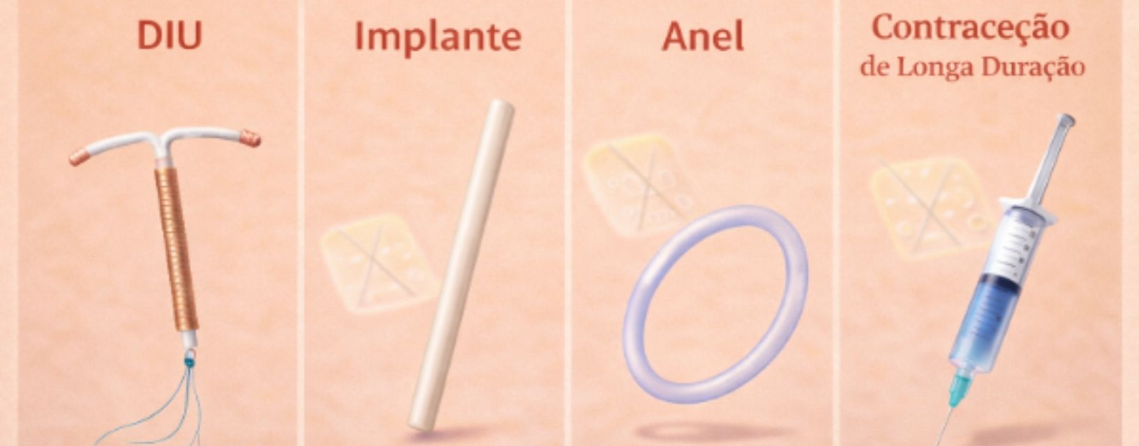 DIU, implante, anel e outros métodos de contraceção de longa duração